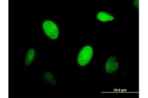 Immunofluorescence of purified MaxPab antibody to CENPJ on HeLa cell.