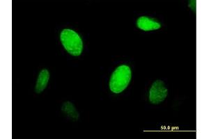 Immunofluorescence of purified MaxPab antibody to CENPJ on HeLa cell. (CENPJ antibody  (AA 1-372))