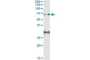 Immunoprecipitation of ACD transfected lysate using mouse monoclonal anti-ACD and Protein A Magnetic Bead (ACD (Human) IP-WB Antibody Pair)