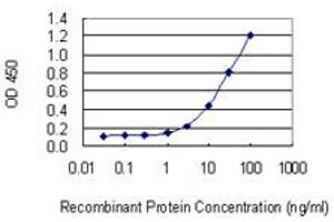 Detection limit for recombinant GST tagged NEDD4L is 0. (NEDD4-2 antibody  (AA 1-100))