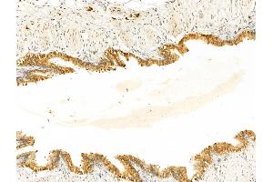 ABIN7094899 and ABIN7098952 at 1/100 staining Rat lung tissue by IHC-P. (ECSIT antibody  (Internal Region))