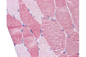 IHC-P Image Immunohistochemical analysis of paraffin-embedded human skeletal muscle , using DAP5, antibody(10 μg/ml). (EIF4G2 antibody  (N-Term))