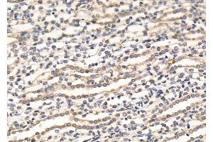ABIN7094476 and ABIN7098524 at 1/100 staining Rat kidney tissue by IHC-P.