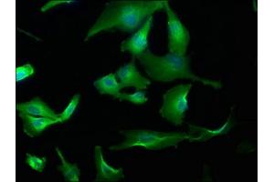 Immunofluorescence staining of U251 cells with ABIN7153709 at 1:173, counter-stained with DAPI. (WDR59 antibody  (AA 619-862))