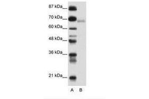 Image no. 1 for anti-Zinc Finger and BTB Domain Containing 22 (ZBTB22) (AA 421-470) antibody (ABIN6736152) (ZBTB22 antibody  (AA 421-470))