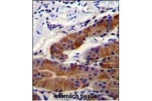 DFNB31 Antibody (Center) (ABIN655065 and ABIN2844695) immunohistochemistry analysis in formalin fixed and paraffin embedded stomach tissue followed by peroxidase conjugation of the secondary antibody and DAB staining. (DFNB31 antibody  (AA 378-406))
