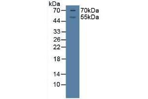 Western Blot; Sample: Porcine Brian Tissue. (Glucocorticoid Receptor antibody  (AA 598-755))