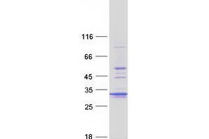 Validation with Western Blot (PSMA5 Protein (Myc-DYKDDDDK Tag))