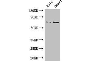 Western Blot Positive WB detected in: Hela whole cell lysate, Mouse heart tissue All lanes: PCK2 antibody at 3. (PEPCK antibody  (AA 101-400))