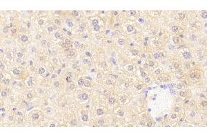 Detection of OSMR in Mouse Liver Tissue using Polyclonal Antibody to Oncostatin M Receptor (OSMR) (Oncostatin M Receptor antibody  (AA 410-652))