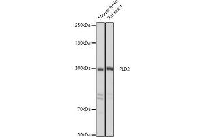 Western blot analysis of extracts of various cell lines, using PLD2 antibody (ABIN6129076, ABIN6145764, ABIN6145765 and ABIN6214347) at 1:500 dilution. (Phospholipase D2 antibody  (AA 1-180))