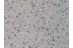 DAB staining on IHC-P; Samples: Human Liver Tissue (CXCL12 antibody  (AA 23-89))