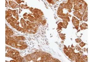 IHC-P Image Immunohistochemical analysis of paraffin-embedded human gastric, using TDP1, antibody at 1:100 dilution. (TDP1 antibody)