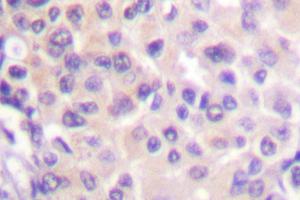 Image no. 1 for anti-Heat Shock Protein 90kDa alpha (Cytosolic), Class B Member 1 (HSP90AB1) antibody (ABIN265474)