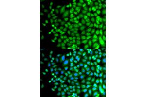 Immunofluorescence analysis of A549 cells using SUPT20H antibody (ABIN5975125). (FAM48A/P38IP antibody)