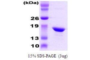 SDS-PAGE (SDS) image for Crystallin, alpha B (CRYAB) protein (ABIN666824) (CRYAB Protein)