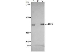 IP Image EGFR antibody [C2C3], C-term immunoprecipitates EGFR protein in IP experiments. (EGFR antibody  (C-Term))
