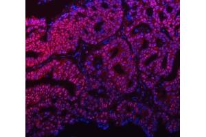 IF analysis of mSin3A/SIN3A using anti-mSin3A/SIN3A antibody (ABIN7602504). (SIN3A antibody  (AA 8-918))
