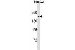 TTBK1 Antibody (Center) (ABIN1881954 and ABIN2838922) western blot analysis in HepG2 cell line lysates (35 μg/lane). (TTBK1 antibody  (AA 667-695))