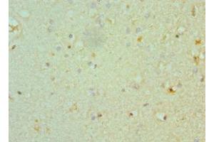 Immunohistochemistry of paraffin-embedded human brain tissue using ABIN7160351 at dilution of 1:100 (CHRM3 antibody  (AA 270-470))