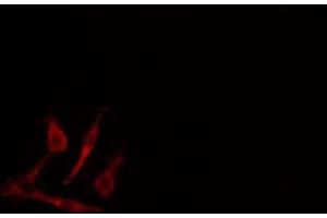ABIN6268777 staining 293 cells by IF/ICC. (Aromatase antibody  (Internal Region))