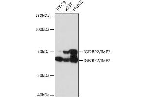 Western blot analysis of extracts of various cell lines, using IGF2BP2/IGF2BP2/IMP2 Rabbit mAb (ABIN7267903) at 1:1000 dilution. (IGF2BP2 antibody)