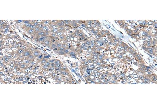 XIRP1 antibody