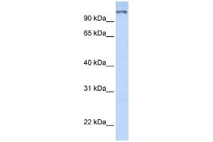 PARP9 antibody used at 1 ug/ml to detect target protein. (PARP9 antibody)