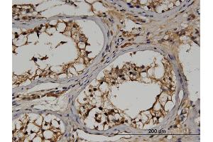 Immunoperoxidase of monoclonal antibody to RGS14 on formalin-fixed paraffin-embedded human testis. (RGS14 antibody  (AA 1-566))