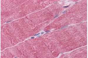 Human Skeletal muscle: Formalin-Fixed, Paraffin-Embedded (FFPE) (WDR77 antibody  (AA 1-343))