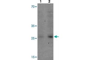 Western blot analysis of VNN3 in human brain tissue with VNN3 polyclonal antibody  at (1) 0.