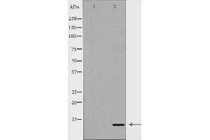 Western blot analysis of Hepg2 whole cell lysates, using SUMO4  Antibody. (SUMO4 antibody)