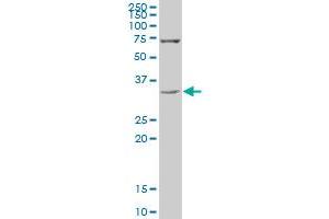 D8S2298E polyclonal antibody (A01), Lot # 060118JC01. (UBXN8 antibody  (AA 173-268))