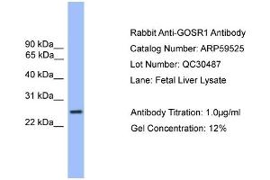WB Suggested Anti-GOSR1  Antibody Titration: 0. (GS28 antibody  (C-Term))