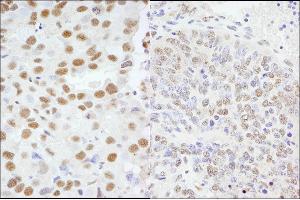 Immunohistochemistry (IHC) image for anti-A Kinase (PRKA) Anchor Protein 8 (AKAP8) (C-Term) antibody (ABIN7454715)