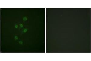 Immunofluorescence analysis of A549 cells, using HDAC3 (Phospho-Ser424) Antibody. (HDAC3 antibody  (pSer424))