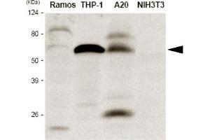 Western blot analysis The extracts of Ramos, THP-1, A20 and NIH3T3 were resolved by SDS-PAGE, transferred to PVDF membrane and probed with anti-human IRF5 antibody (1:1,000).