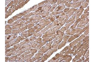 IHC-P Image alpha Cardiac Muscle Actin antibody detects alpha Cardiac Muscle Actin protein at cytoplasm on mouse heart by immunohistochemical analysis. (ACTC1 antibody)