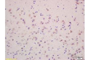 Formalin-fixed and paraffin embedded rat brain labeled with Rabbit Anti VEGF-A Polyclonal Antibody, Unconjugated (ABIN707186) at 1:200 followed by conjugation to the secondary antibody and DAB staining (VEGFA antibody  (AA 141-180))