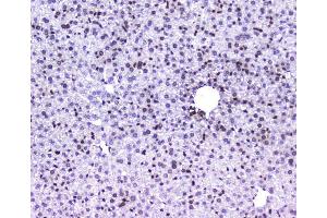 IHC analysis of AHR using anti-AHR antibody (ABIN6719265). (Aryl Hydrocarbon Receptor antibody)