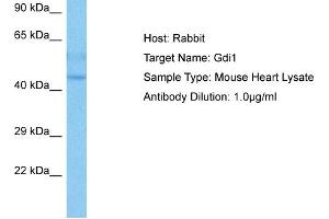 Host:  Mouse  Target Name:  GDI1  Sample Tissue:  Mouse Heart  Antibody Dilution:  1ug/ml (GDI1 antibody  (C-Term))
