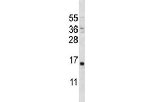 PTH antibody western blot analysis in MDA-MB231 lysate. (PTH antibody  (AA 59-88))