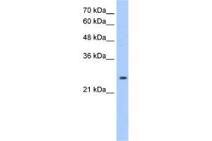 WB Suggested Anti-PRDX6 Antibody Titration:  1. (Peroxiredoxin 6 antibody  (Middle Region))