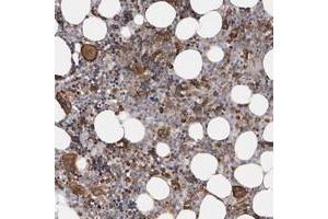 Immunohistochemical staining of human bone marrow with TIMM17B polyclonal antibody  shows strong cytoplasmic positivity in bone marrow poietic cells.