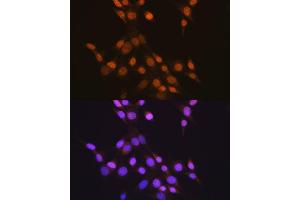 Immunofluorescence analysis of NIH-3T3 cells using CTCF antibody (ABIN7266164). (CTCF antibody)