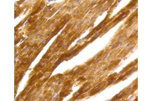 Immunohistochemistry (IHC) image for anti-Protein Kinase C, alpha (PKCa) antibody (ABIN4904772)