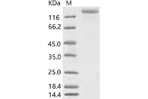Western Blotting (WB) image for HCoV-NL63 S1 Protein protein (His tag,ECD) (ABIN7198831) (HCoV-NL63 S1 Protein protein (His tag,ECD))