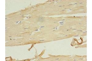 Immunohistochemistry of paraffin-embedded human skeletal muscle tissue using ABIN7158082 at dilution of 1:100 (LRRN1 antibody  (AA 26-631))