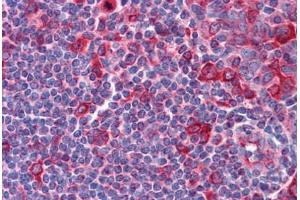 Immunohistochemistry (Formalin-fixed Paraffin-embedded Sections) (IHC (fp)) image for anti-alpha Tubulin (TUBA1) antibody (ABIN573979)