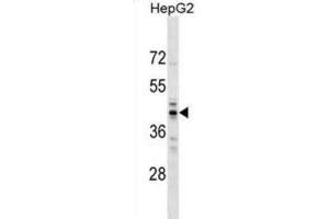 Western Blotting (WB) image for anti-RNA (Guanine-9-) Methyltransferase Domain Containing 2 (RG9MTD2) antibody (ABIN2999749) (RG9MTD2 antibody)